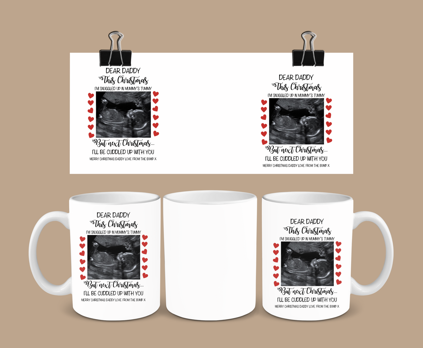 Daddy To Be Scan Photo Mug | Christmas Bump Mug | Gift Idea