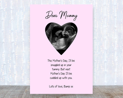 Mothers Day Card | Dear Mummy Scan Photo Card | Mummy To Be Card | From The Bump Card